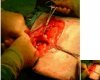 surgery_IL0.jpg