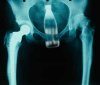 x_ray_report.jpg